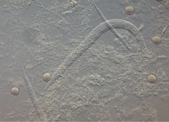 接合菌類（線虫捕食菌類）のRhopalomyces elegans